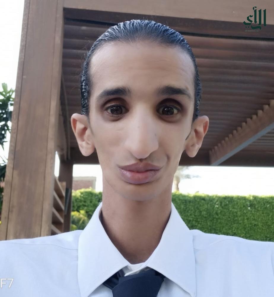 ميدو فايز